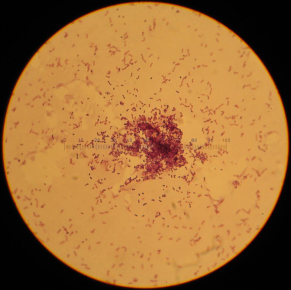 Cheese Cultures (Mesophilic & Thermophilic) — The one you'd recognize